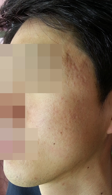 전후사진