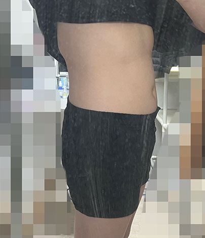 전후사진