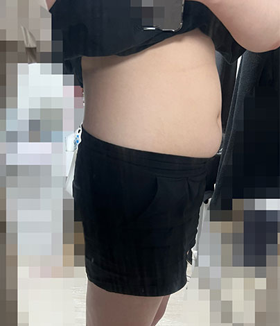 전후사진