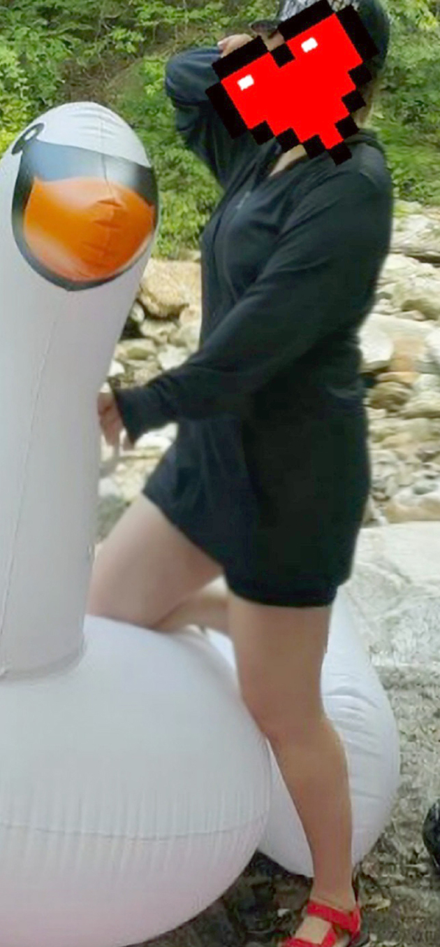 치료 전