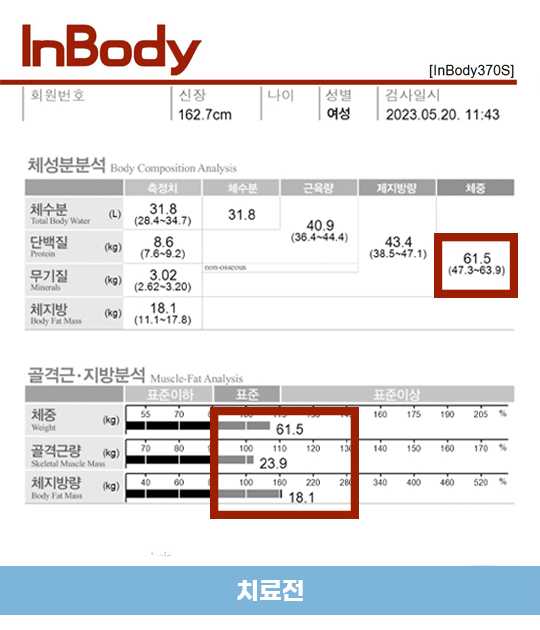 전후사진