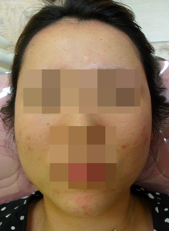 전후사진