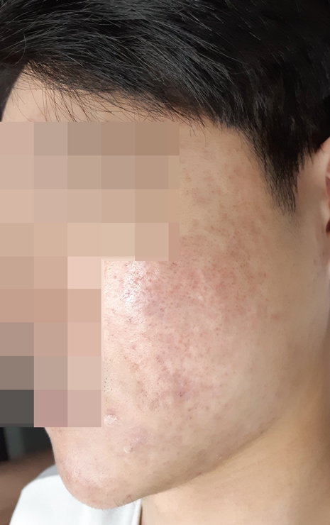전후사진