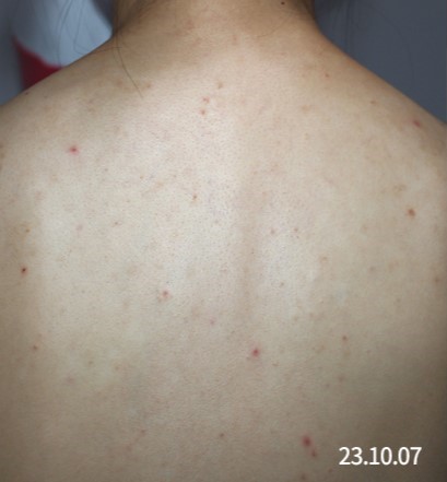 전후사진