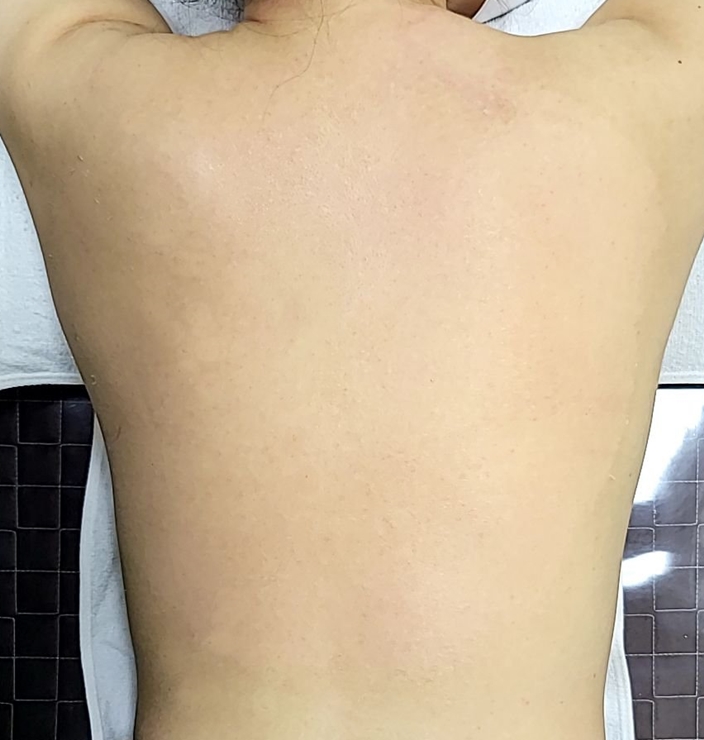 전후사진