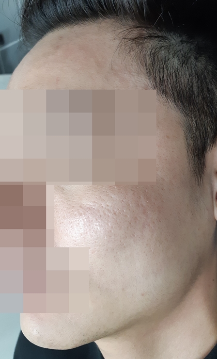 전후사진