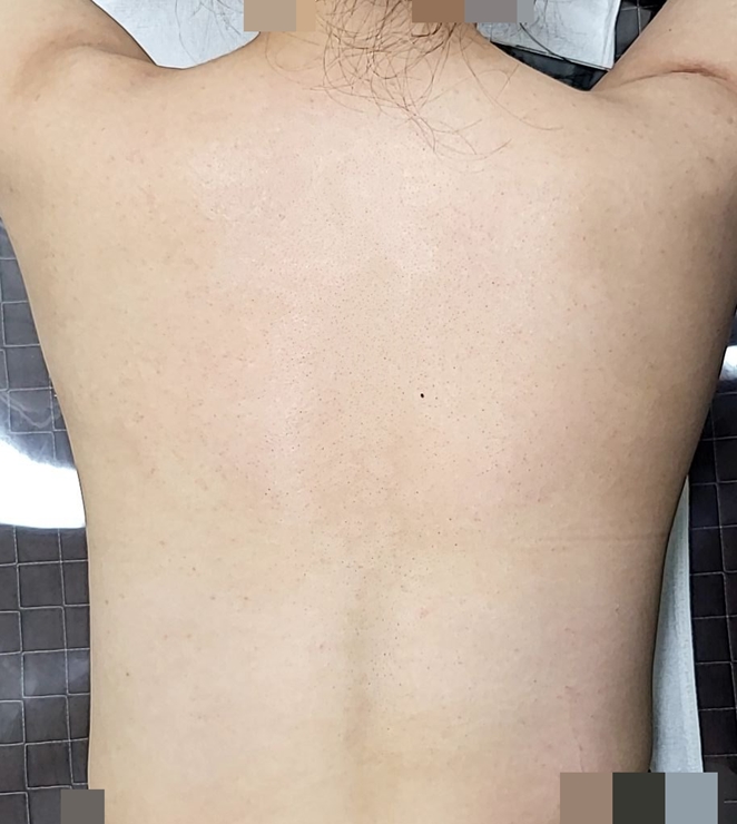 전후사진