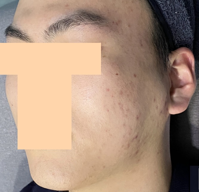 전후사진