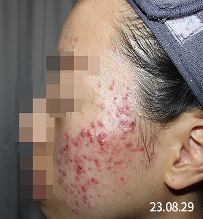 전후사진