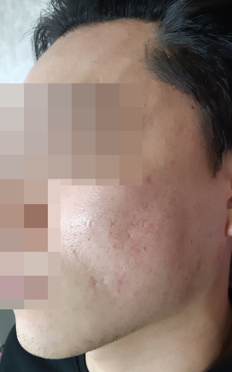 전후사진