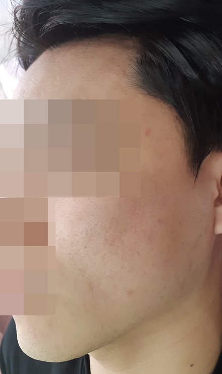 전후사진