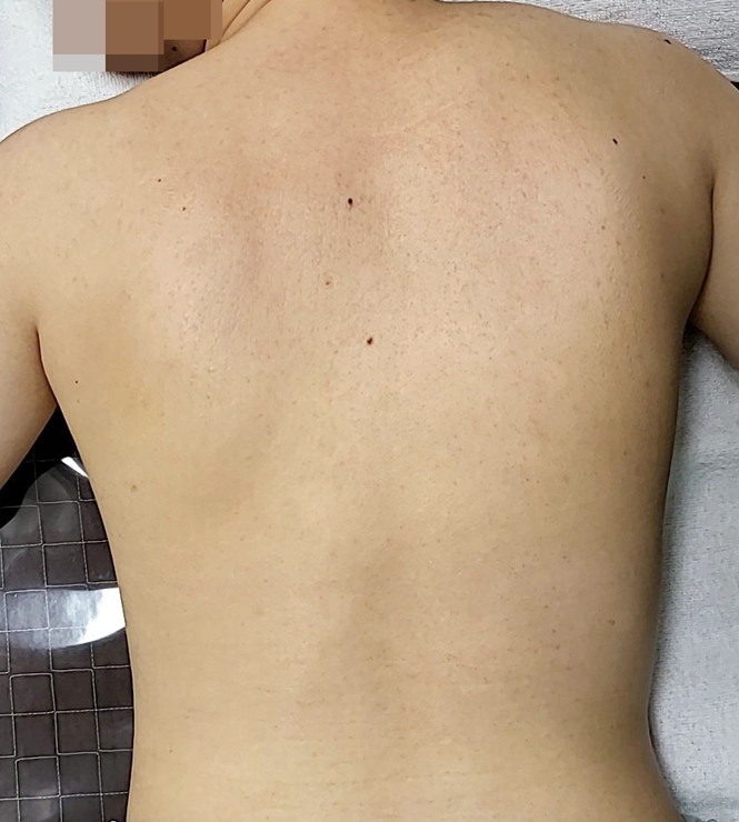 전후사진