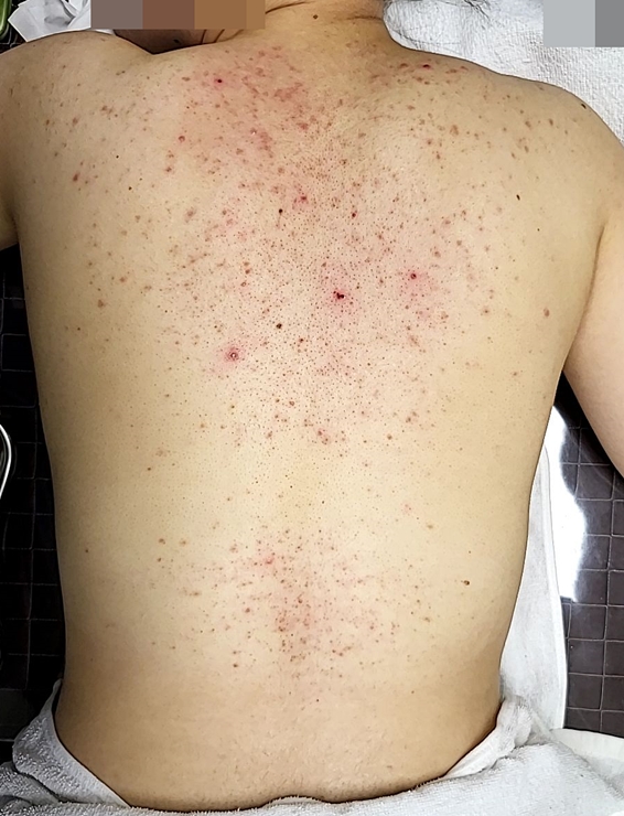 전후사진