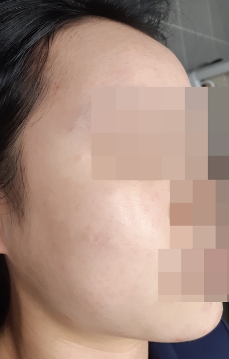 전후사진