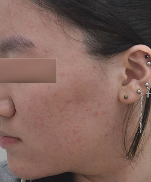 전후사진