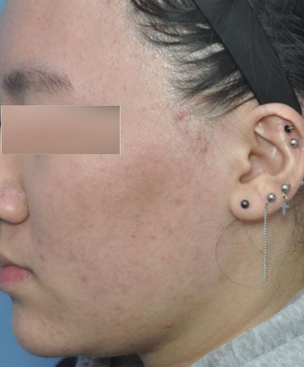 전후사진