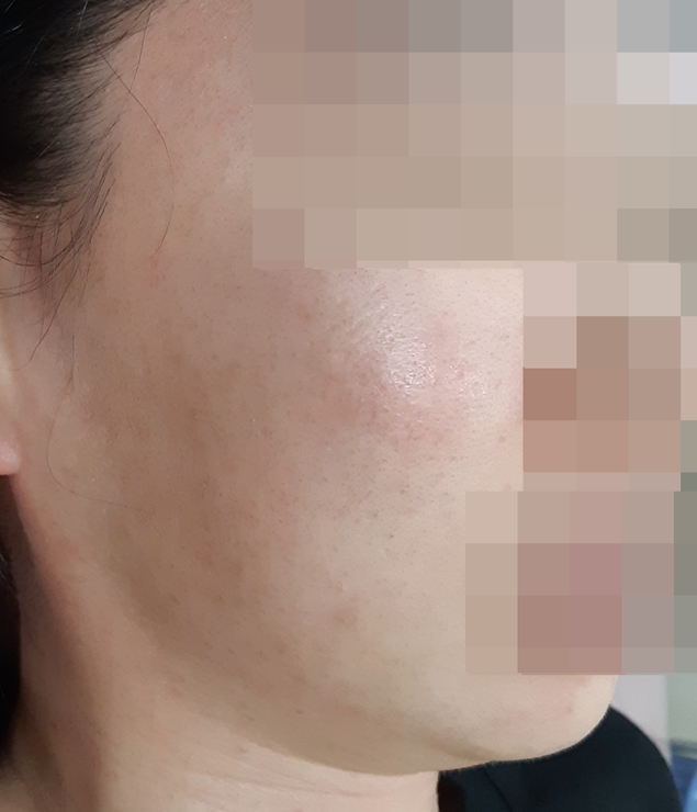 전후사진