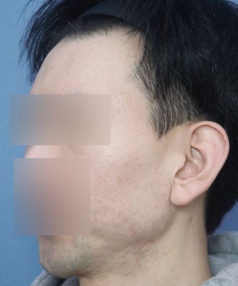 전후사진