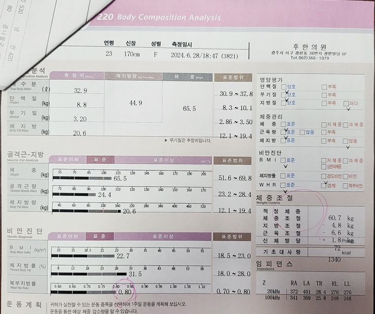 전후사진