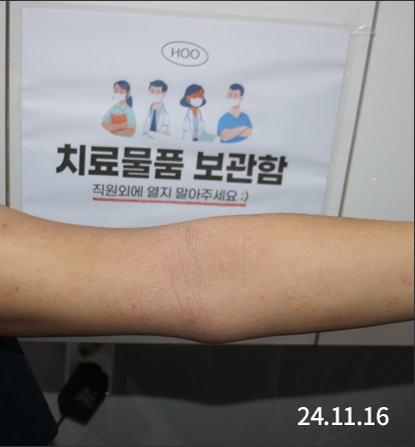 전후사진