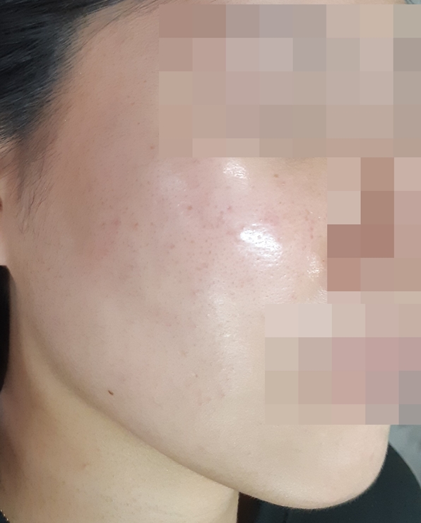 전후사진