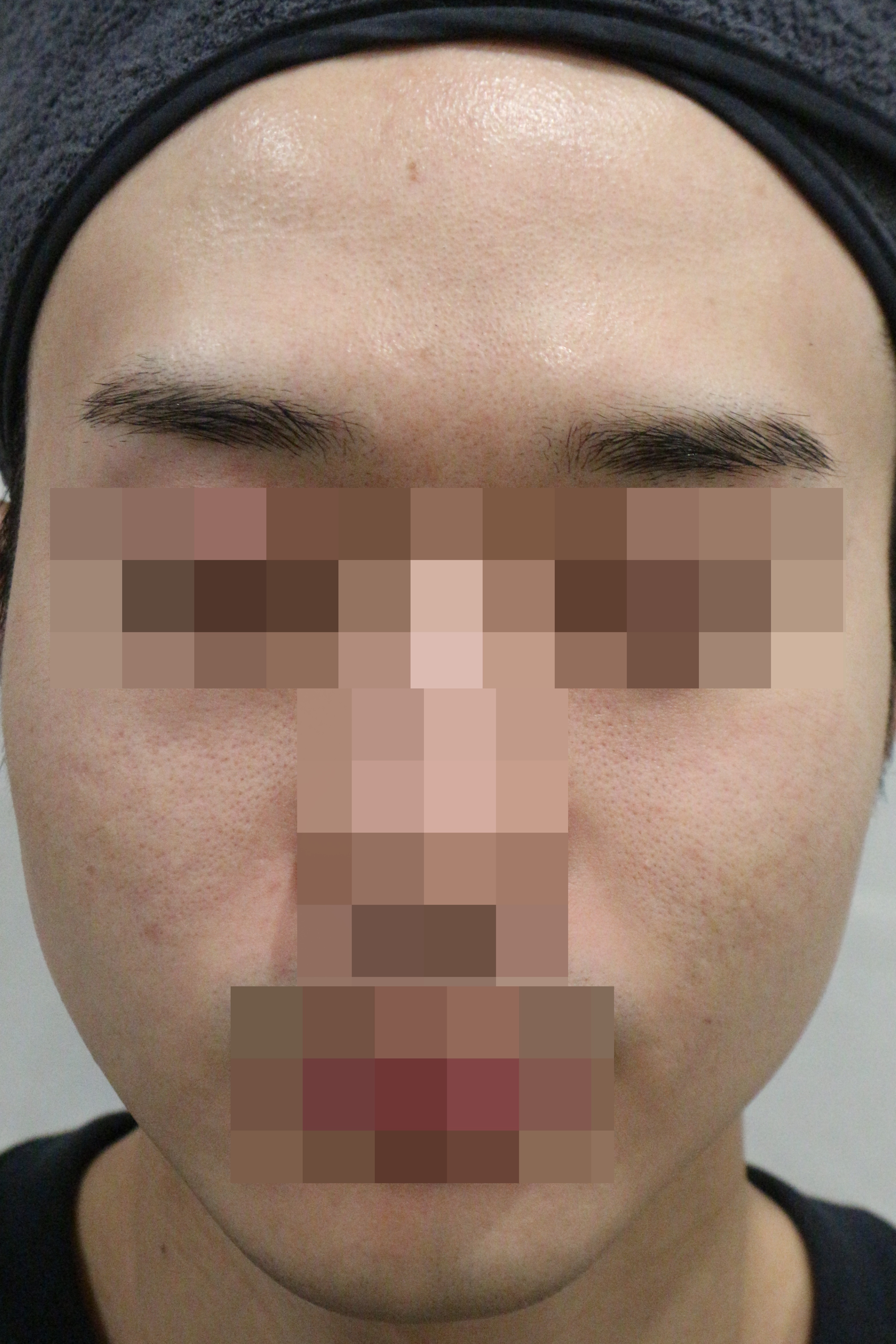 전후사진