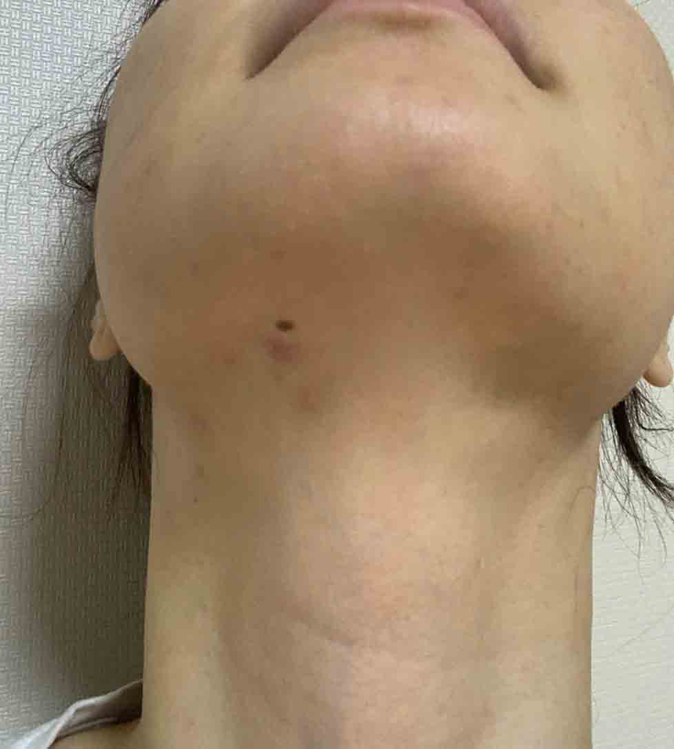 전후사진