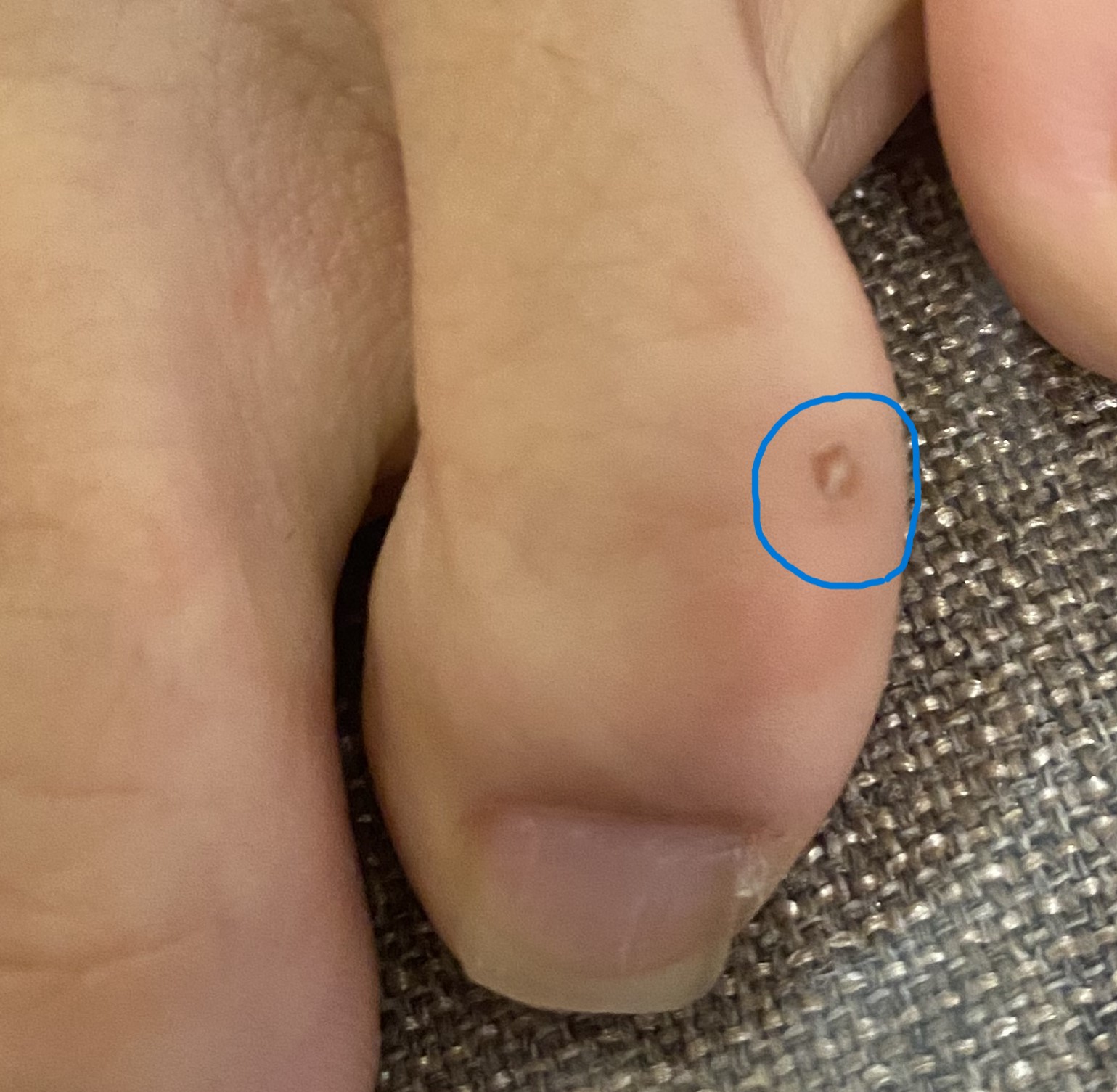 치료 전