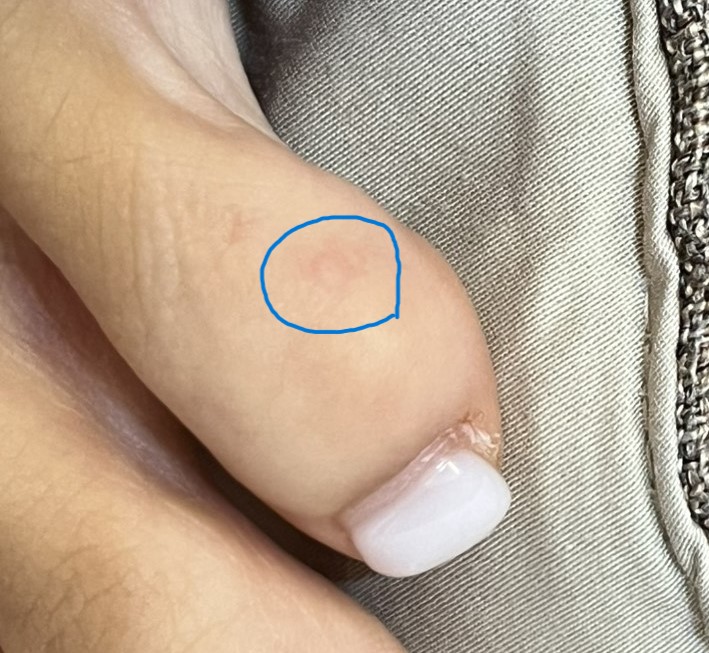 치료 후