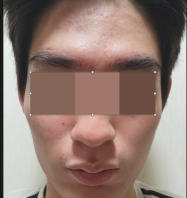 전후사진