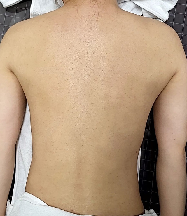 치료 후