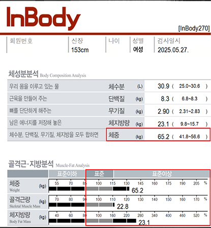 전후사진