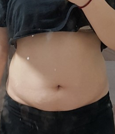 치료 전