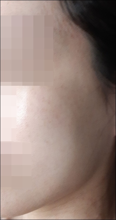 전후사진
