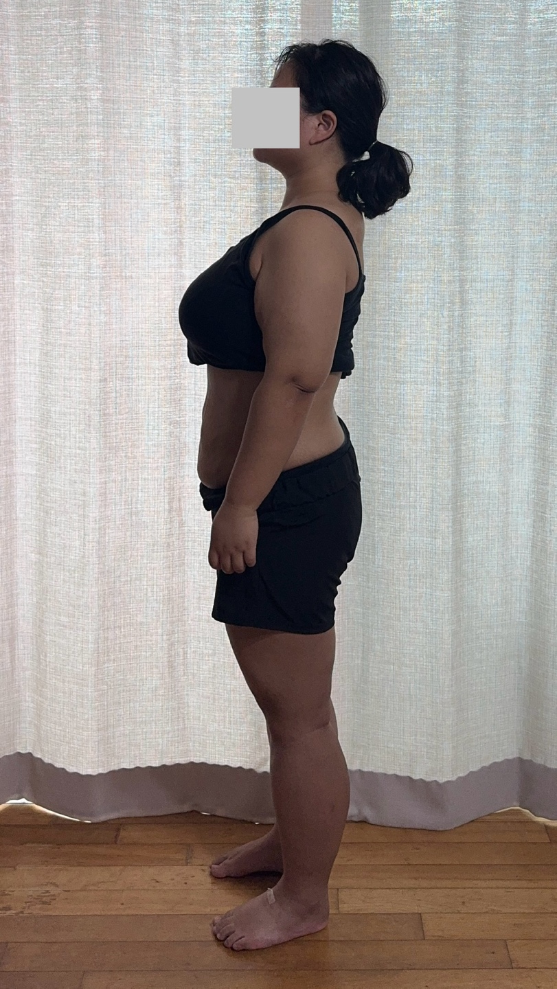 치료 후