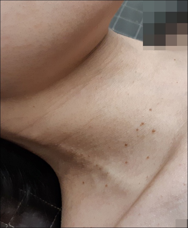 치료 전