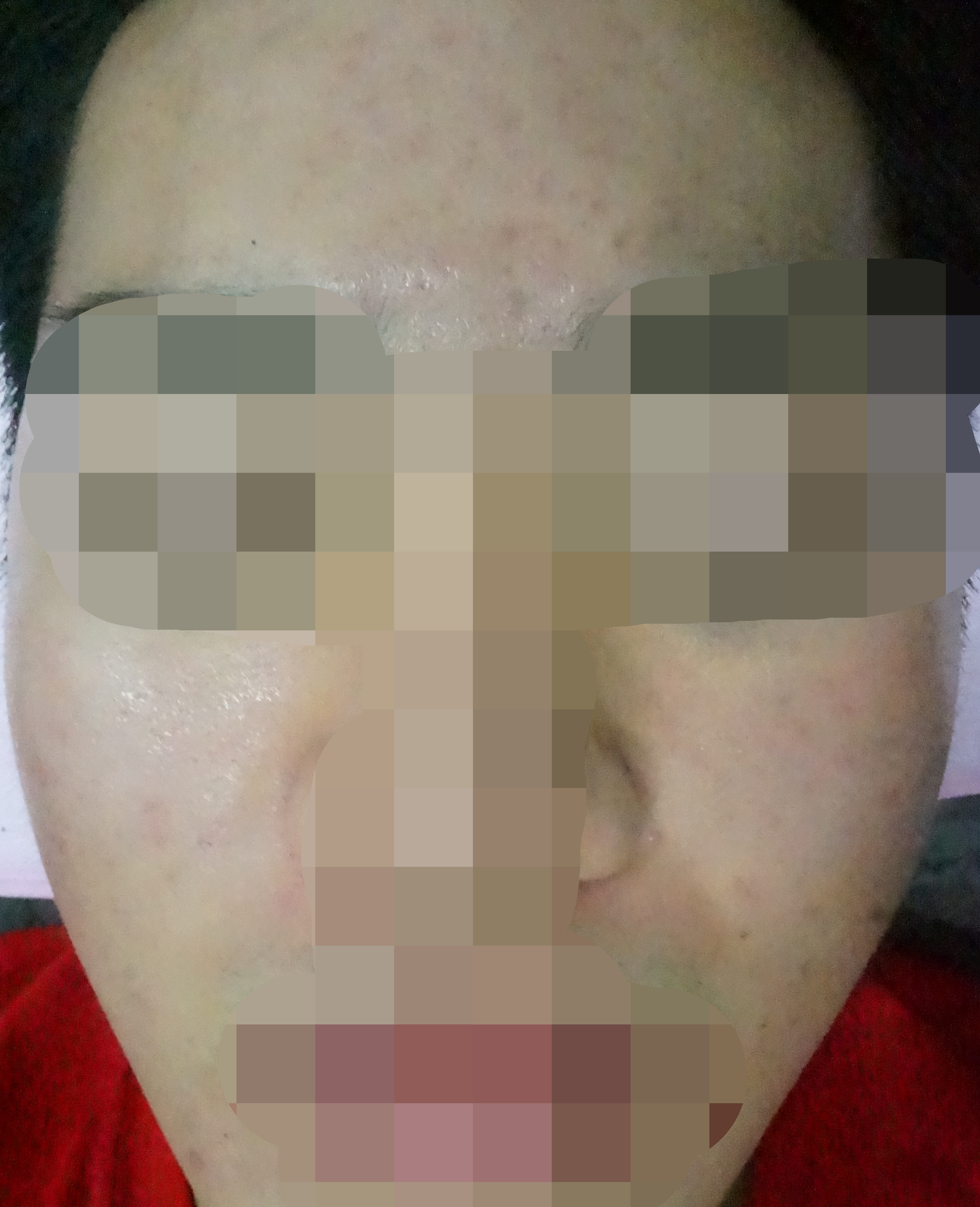 치료 후