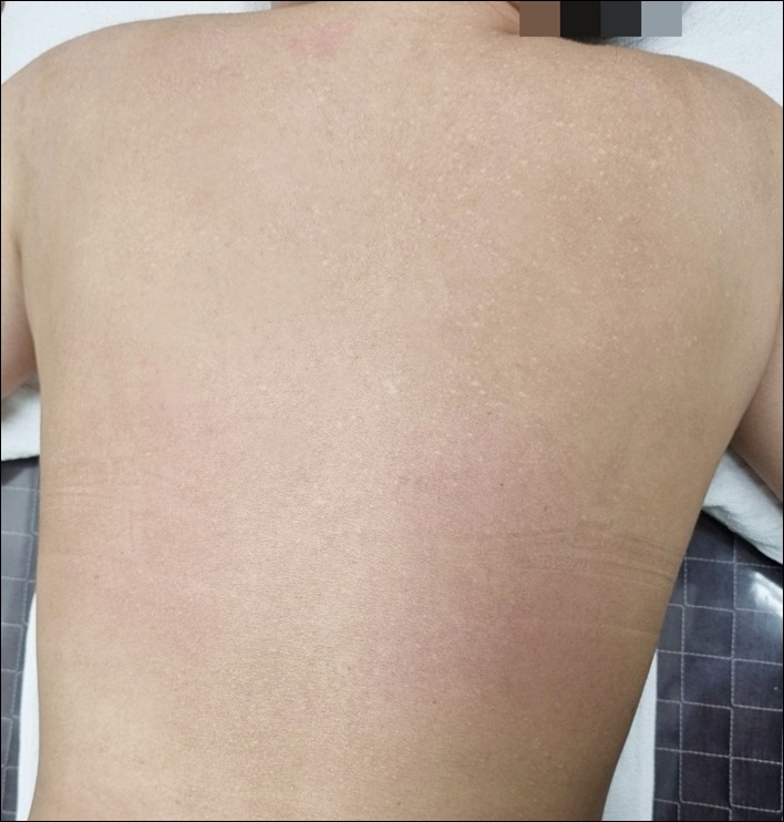 치료 후