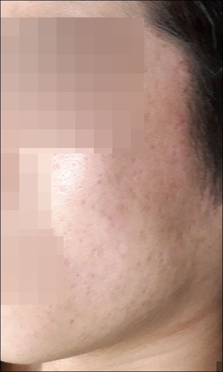 전후사진