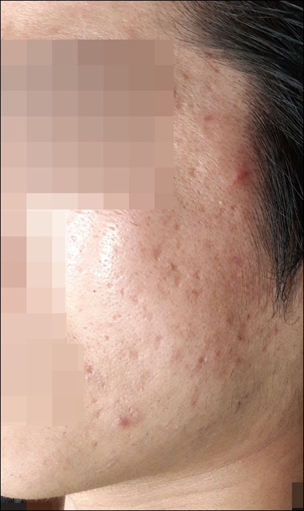 전후사진