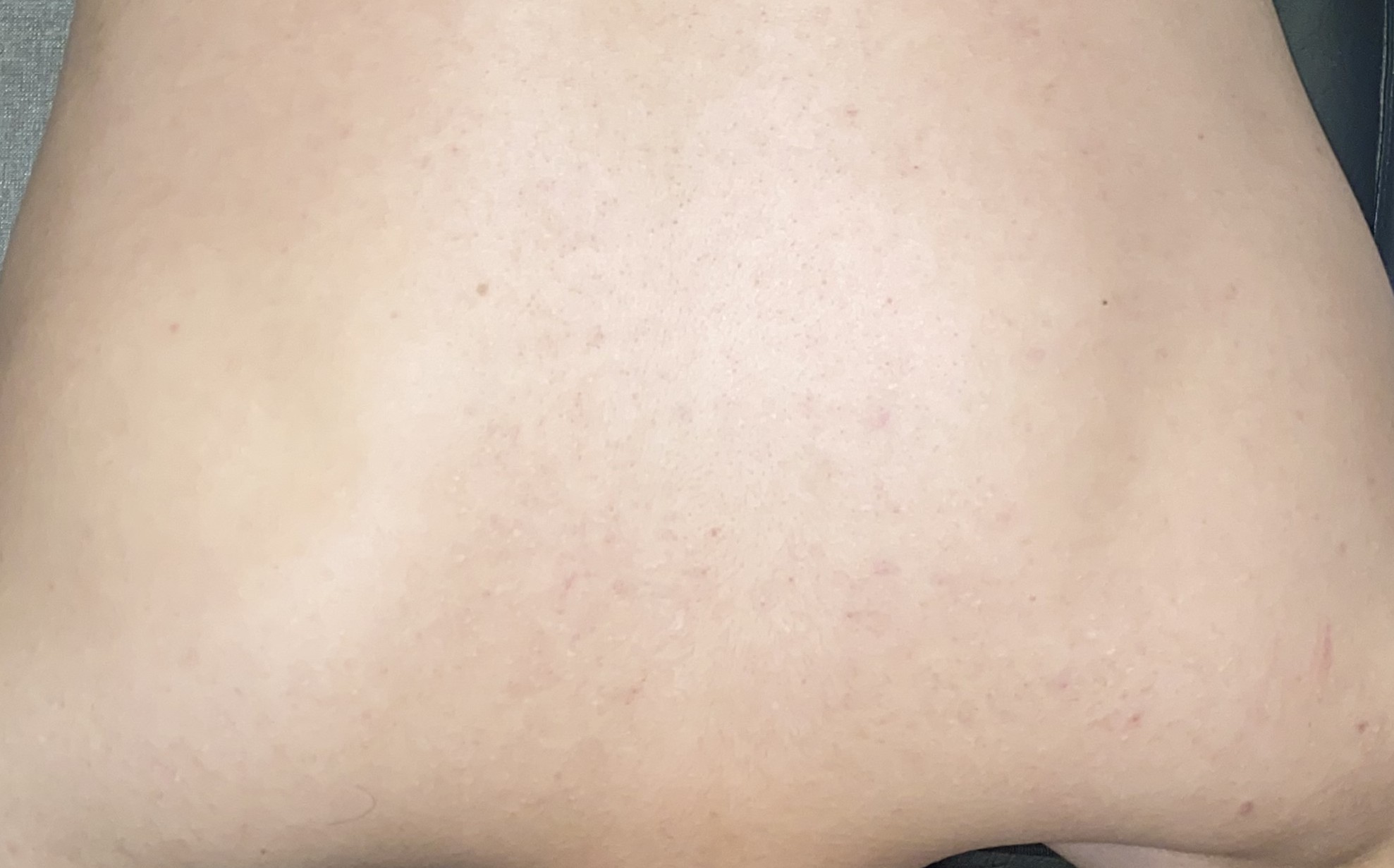 전후사진